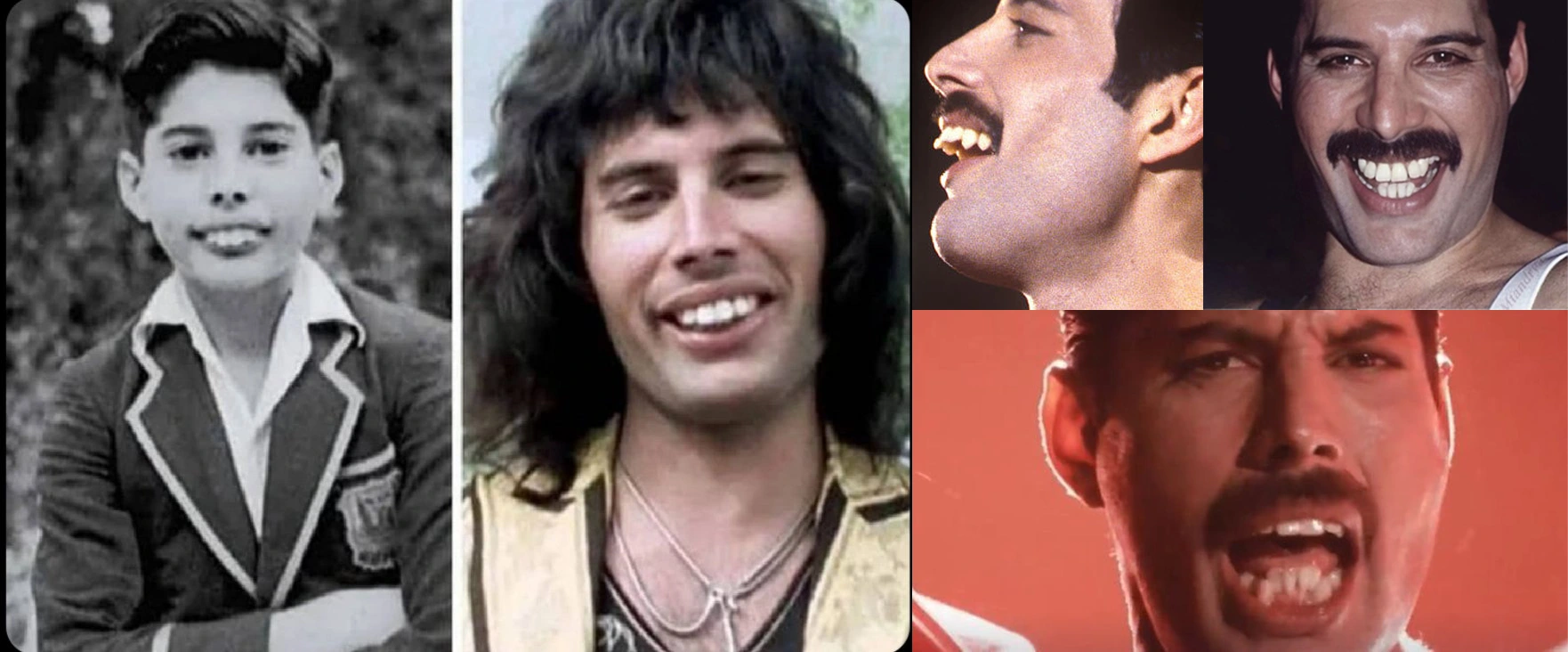 freddie mercury teeth